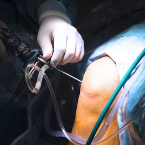 Servicios de Traumatología en Rancagua